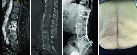 Imaging Of The Patient Before And After Treatment A Gadolinium