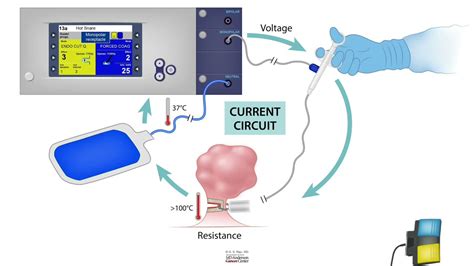 Hcc 1472 Lesson 16b Electrosurgery Monopolar Vs Bipolar Devices Youtube