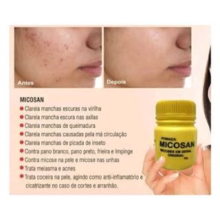 4 UN Pomada Micosan Original Para Micoses E Clareador De Manchas 50g