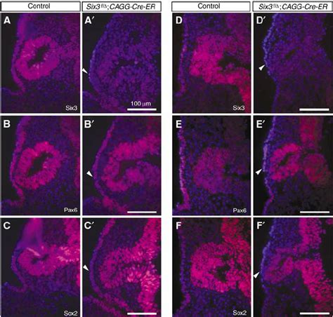 Early Deletion Of Six3 Downregulates Pax6 Preplacodal Expression