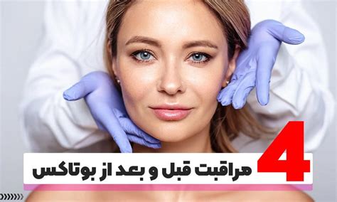 22 نکته مراقبت قبل و بعد از بوتاکس دوره آموزش بوتاکس آرپسه