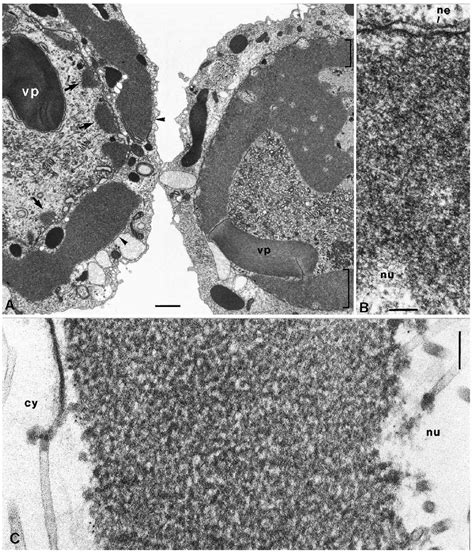 Electron Micrographs Of Ultrathin Sections Through Sf9 Cells Showing