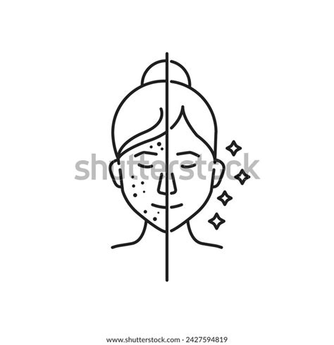 Woman Acne Clean Face Skin Line Stock Vector Royalty Free 2427594819