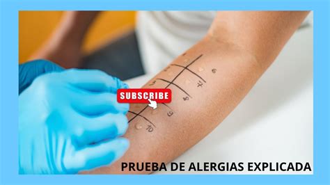 Prueba Cut Nea Intraepid Rmica De Alergias Prick Test Prueba De