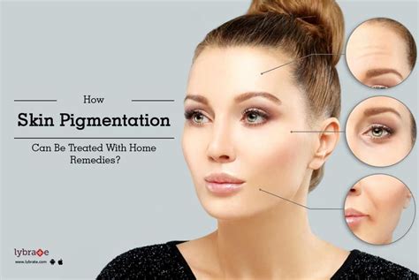 Face Pigmentation Treatment At Home - Doctor Heck