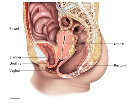 Prolapsed Uterus Stages