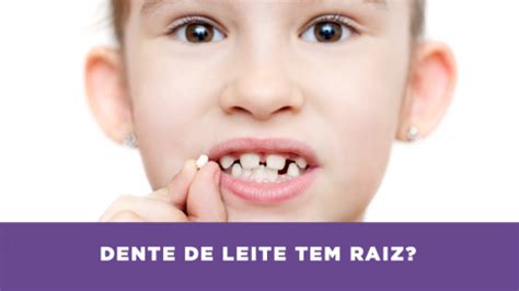 Dente De Leite Tem Raiz Sorrix