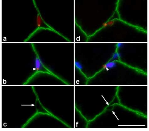 Pax7 Staining And Myonuclei Control Section From A C Subject Stained