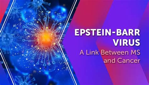 Epstein-Barr Virus: A Link Between MS and Cancer | MyMSTeam