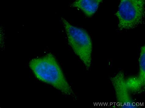 PPP3CA Antibody CL488 13422 Proteintech