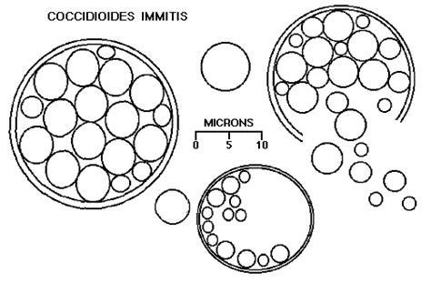 Aids Pathology