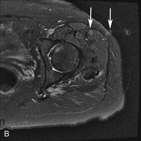 Pulsation And Other Artifacts Radiology Key