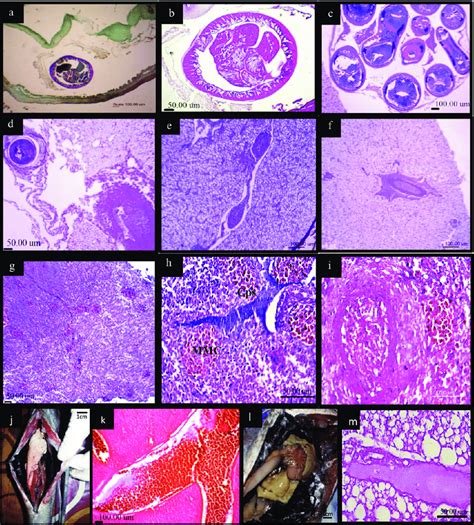 Histological Sections Through The Intestine Liver And Spleen Of P