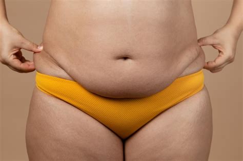 Imagem Recortada De Closeup Barriga De Mulher Excesso De Peso