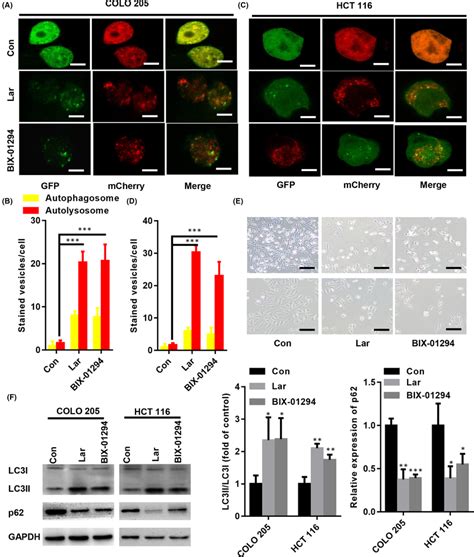 Lar Enhanced Autophagic Flux In COLO205 And HCT116 Cells Lar Or