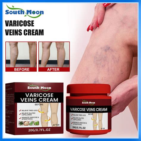 South Moon Varicose Veins Cream Medical Plaster Improves Blood