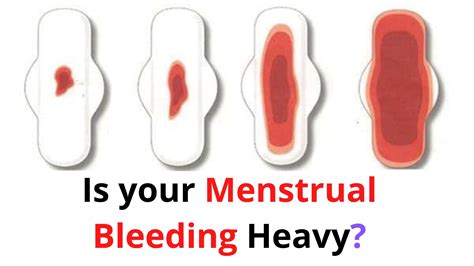 How Can I Stop My Period From Bleeding Heavy At Roger Odonovan Blog