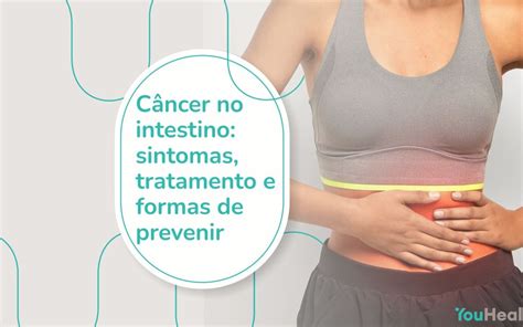 C Ncer No Intestino Sintomas Tratamento E Formas De Prevenir