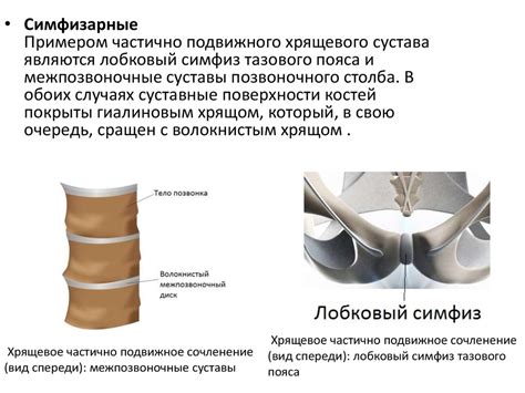 Суставы - презентация онлайн