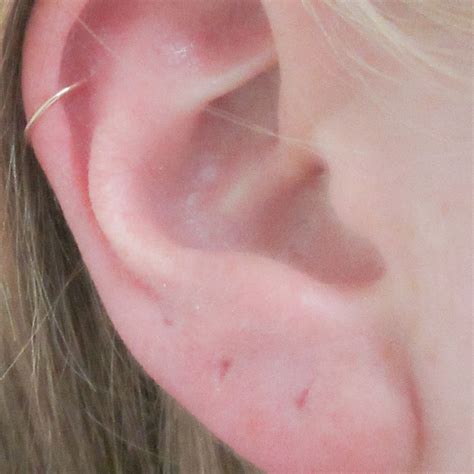 How Do I Make My Pierced Ear Hole Smaller At Natasha Pamela Blog