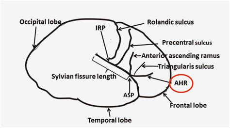 Sylvian Fissure Anatomy