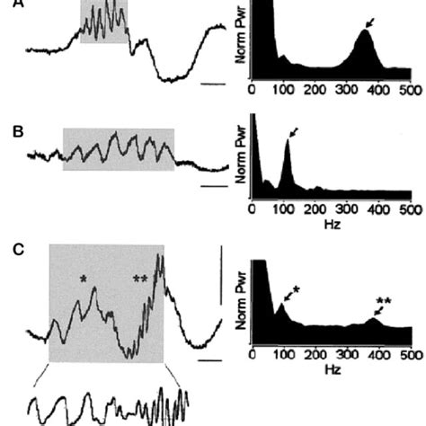 High frequency oscillations (HFOs) and power spectral analysis. Left ...