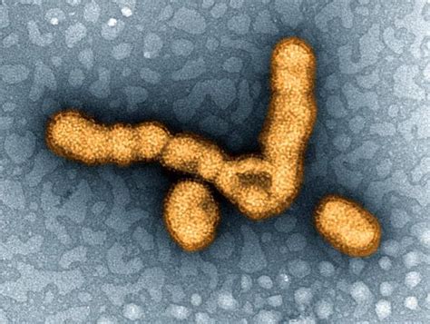 The 9 Deadliest Viruses on Earth | Live Science