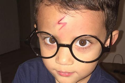 Mom Turns Her Four-year Old Son's Scar Into a Very Accurate Harry ...