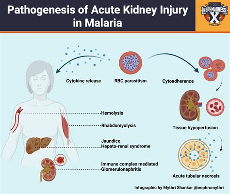 Nm22 Parasites Malaria Pathogenesis Ajkd Blog