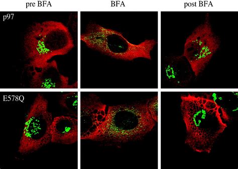 Distinct Roles For The Aaa Atpases Nsf And P97 In The Secretory Pathway