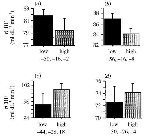 Graphical Displays Of The Mean Rcbf Values In Ml Dl Min At The