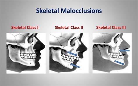 Lec 07 Skeletal And Dental Maturity Indicators