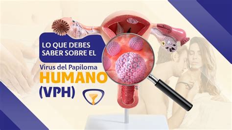 Cosas Que Deber As Saber Sobre El Virus Del Papiloma Humano Vph Sexiz Pix