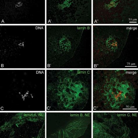 Localization Of DNA Topoisomerase II Topo II A And ATRX B In The