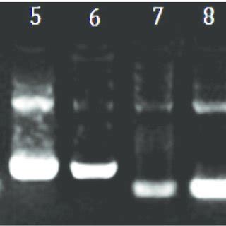 Ethidium Bromide Stained Agarose Gel Showing Pcr Products Representing