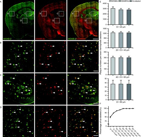 Accuracy Of The Whole Brain Amyloid Plaque Staining Method A Dual