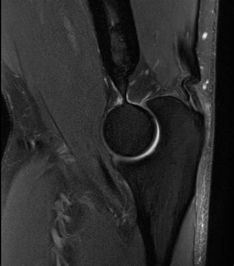 Imaging With The Ds 16ch Small Extremity Coil Philips Mr Body Map