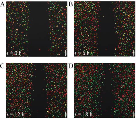 Figure From A Novel Free Boundary Mathematical Model Of Epithelial