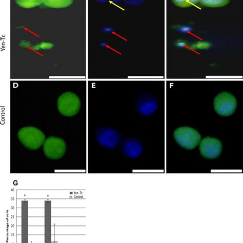 A To F Fluorescence Micrographs Of Caco Cells Topically Treated