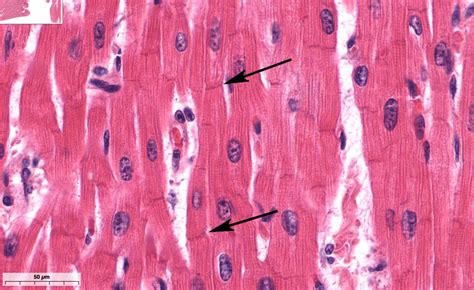 Histologia Del Miocardio Músculo Cardiaco Explicación Fácil