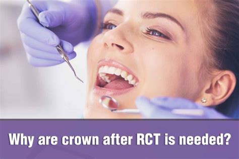 Why Are Crown After RCT Is Needed Dr Bhimani