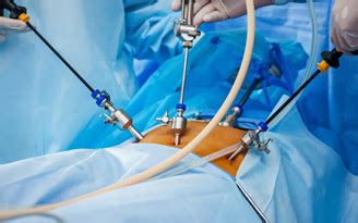 Laparoscopic Surgery hospital Jaipur | Laparoscopic Surgery In Jaipur | Laparoscopic Surgery ...