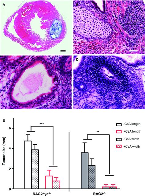 Teratomas In Immunodeficient Rag2 −− γc −− And Rag2 −− Mice With