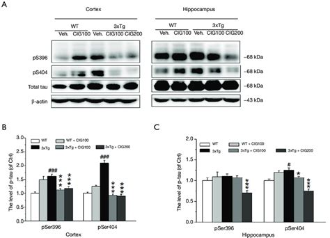 Cig Inhibits Tau Hyperphosphorylation In The Cerebral Cortex And