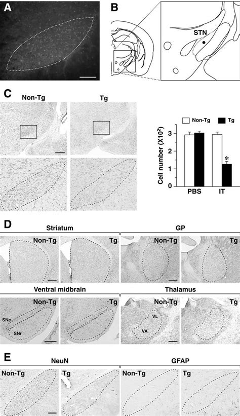 Conditional Ablation Of Stn Neurons In Np Il R Gfp Tg Mice A