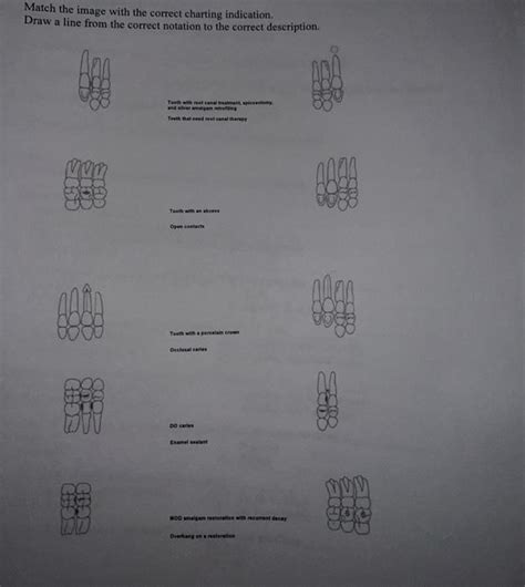 dental charting Dental charting | Chegg.com