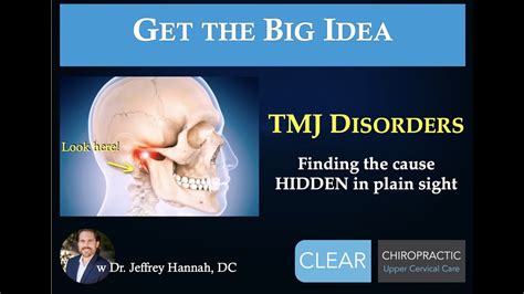 Tmj Disorders Jaw Pain And The Atlas Finding The Hidden Cause Upper