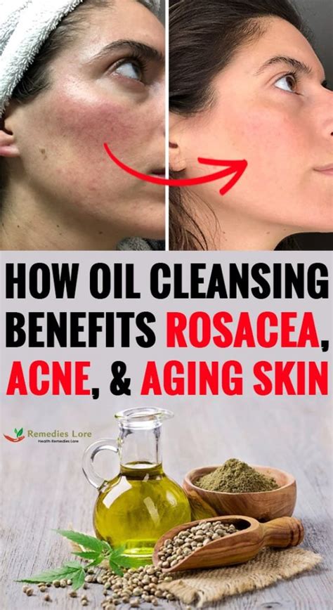 How Oil Cleansing Benefits Rosacea Acne And Aging Skin Remedies Lore