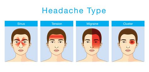 Cluster Migraines: 1000 Out Of Ten On The Pain Scale