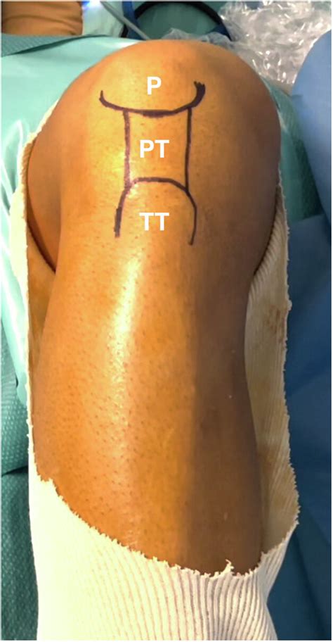 Patient Positioning And Landmarks Right Knee Frontal View Positioned Download Scientific